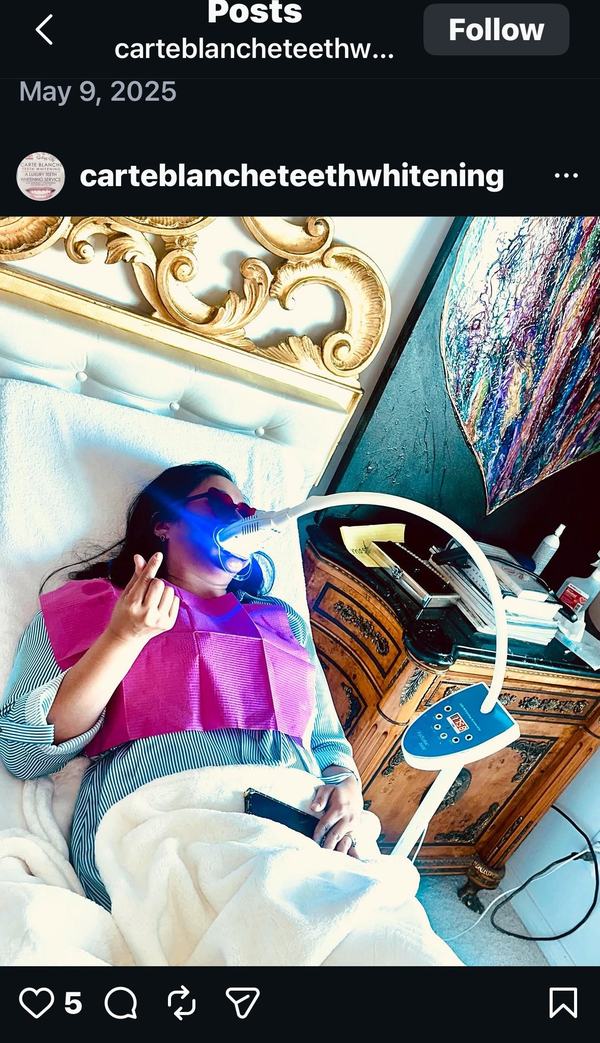 Carte Blanche mobile teeth whitening setup at a Los Angeles client home