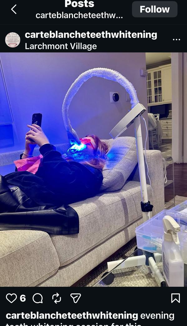 Luxury at-home teeth whitening session by Carte Blanche in Beverly Hills