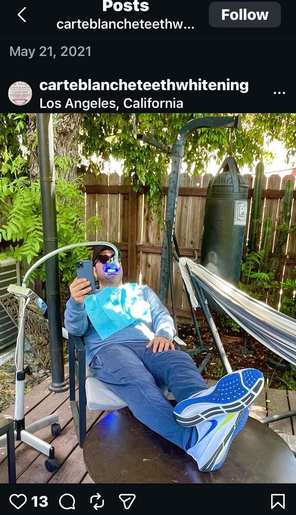 Carte Blanche mobile teeth whitening client receiving in-home spa session
